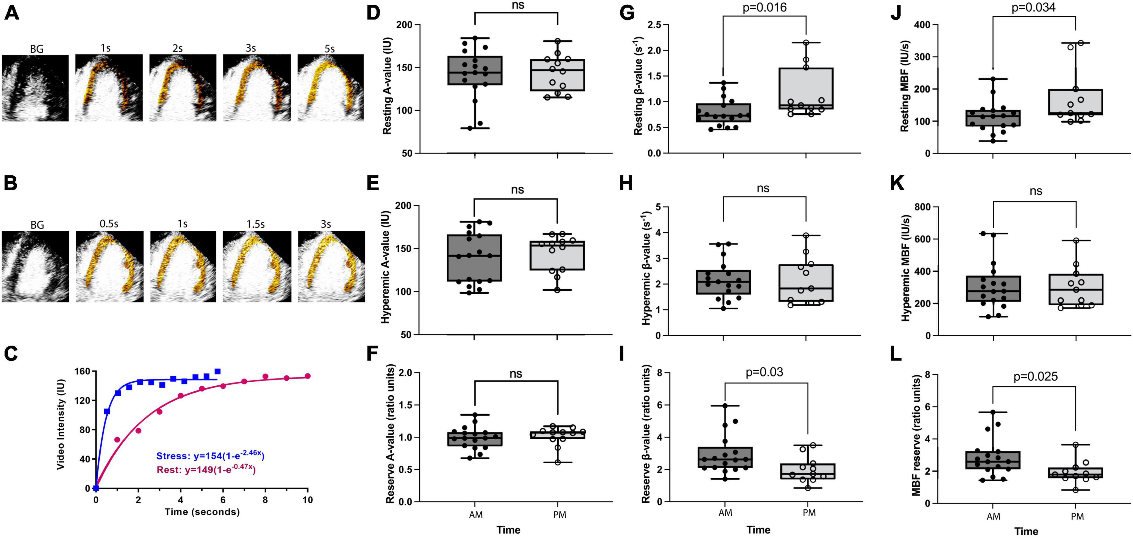 Resting coronary flow drives the daily pattern in coronary flow reserve in patients with chest pain without obstructive epicardial stenosis